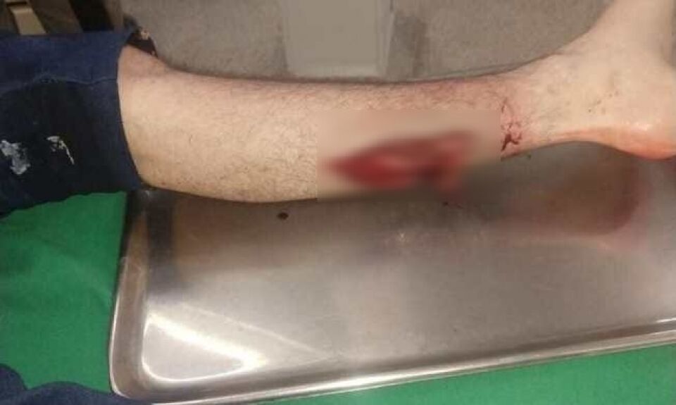 Policial de RO é vítima de tiro acidental em rio branco