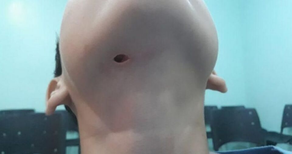 Após filho quase ter artéria perfurada, mãe agradece livramento e deixa alerta