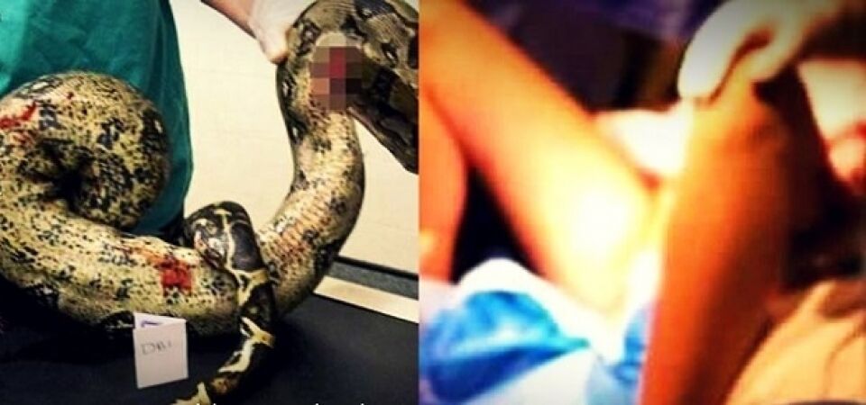 Mulher introduz cobra dentro da vagina para prazer sexual e quase morre