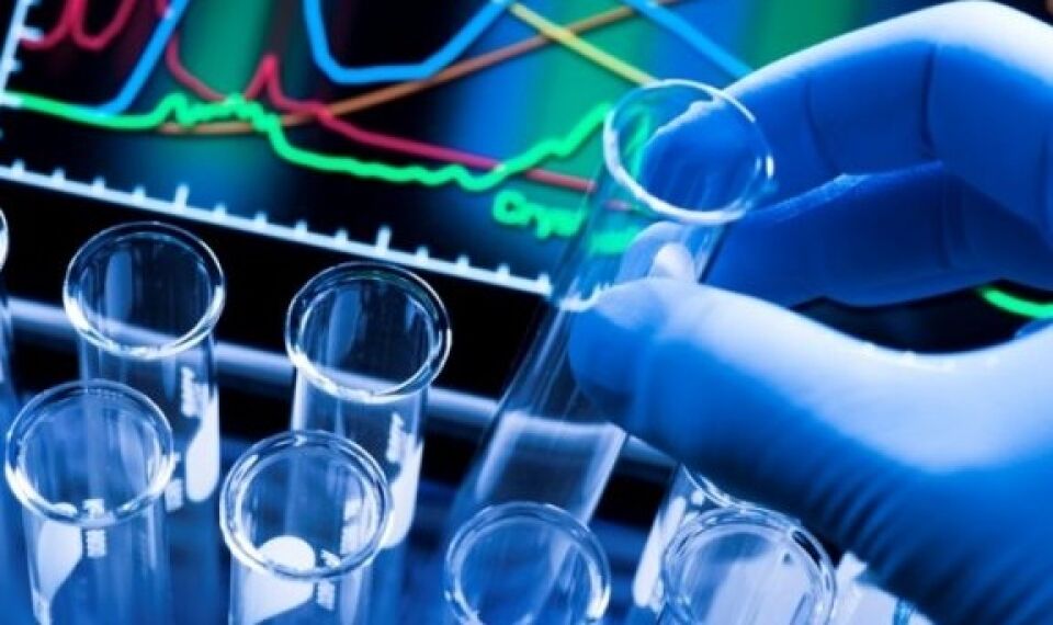 Partidos custam 4 vezes o investimento em pesquisa