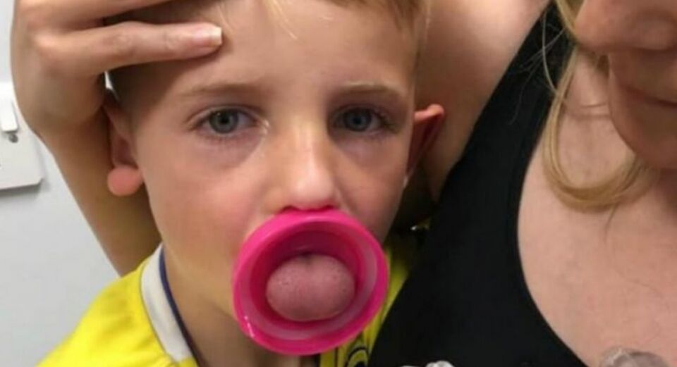 Menino de 6 anos passa por cirurgia arriscada após ficar com língua presa em garrafa, fotos