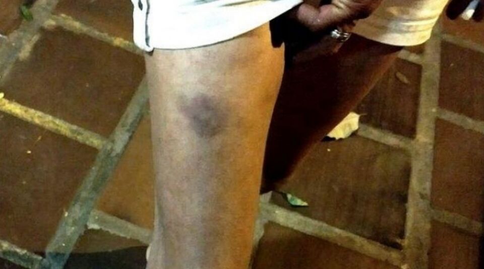 Sobrinho é acusado de espancar a tia em residência na zona Sul de Porto Velho