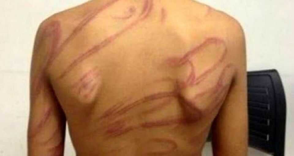 Filho é surrado pelo pai com mangueira após discurti com madrasta