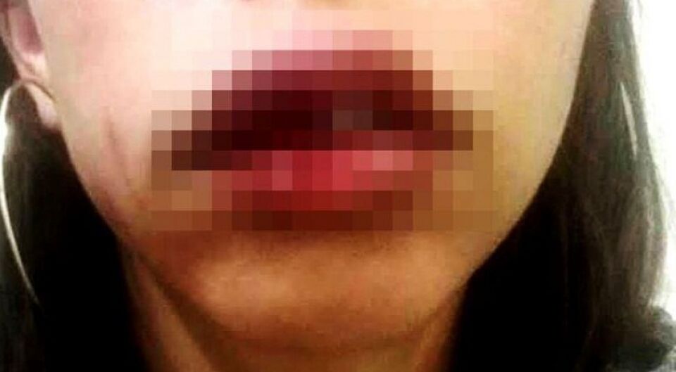 AGRESSÃO: Mecânico espanca ex-namorada ao encontrá-la na casa do atual