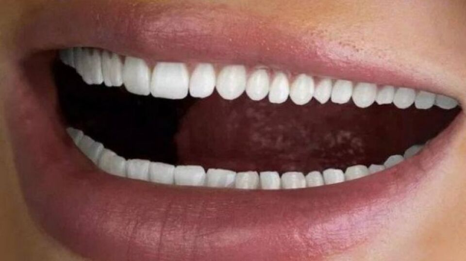 Empresa usa modelo com '60 dentes' para propaganda de clareamento