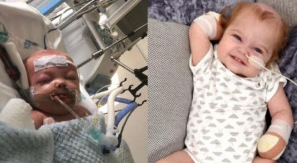 ALERTA: Bebê perde membros após infecção grave que começou na garganta