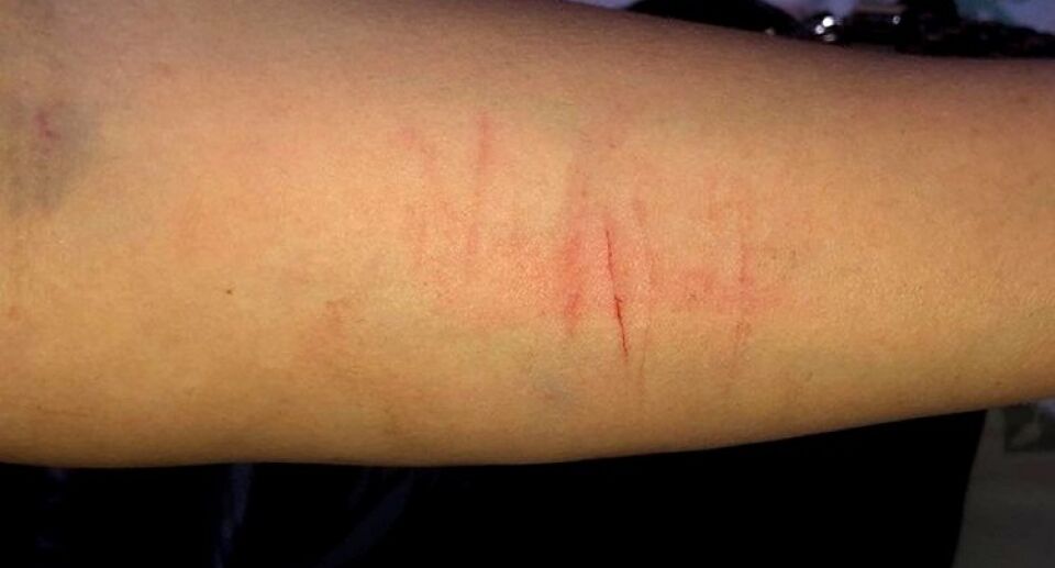 VIOLÊNCIA: Esposa abandonada em bar é espancada por marido ao pegar carona com amigo