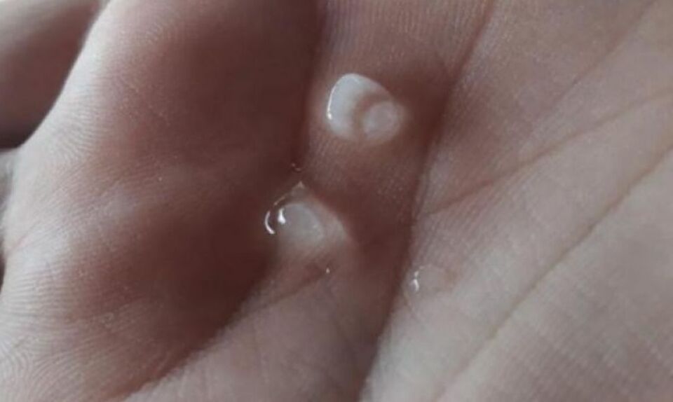 VÍDEO: Chuva com granizo assusta moradores em Rolim de Moura