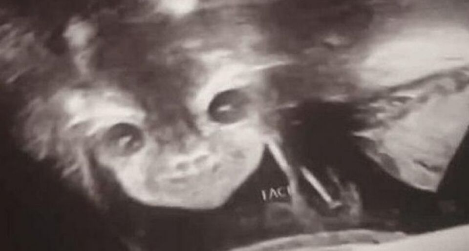 Mãe fica assustada ao ver 'bebê demônio' sorrindo em ultrassom