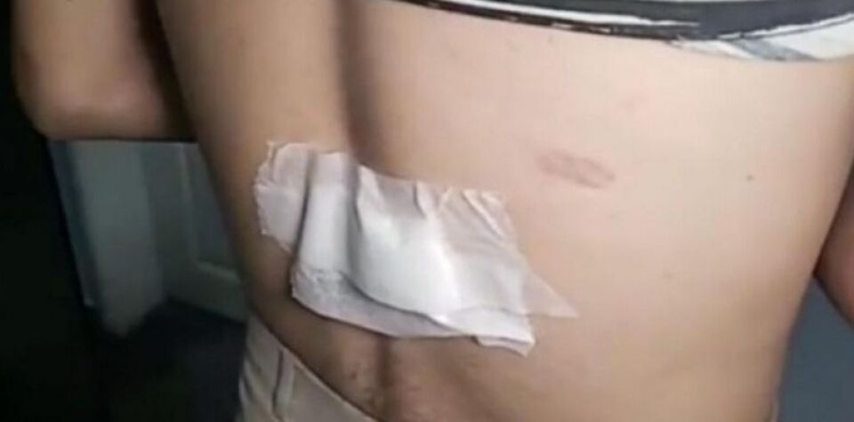 Pai embriagado tenta matar filho esfaqueado por ler a Bíblia